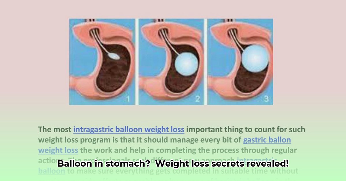 balloon-in-stomach-for-weight-loss-cost